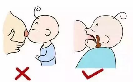 对策:宝宝吃母乳时,要让他含住大部分乳头和乳晕,才能更容易的吸出